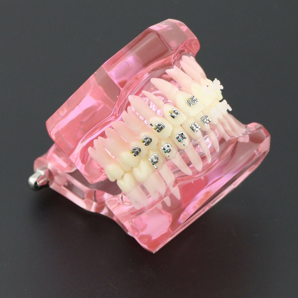 Dental Orthodontic Demonstration Ceramic and Metal Bracket Study Typodont Model