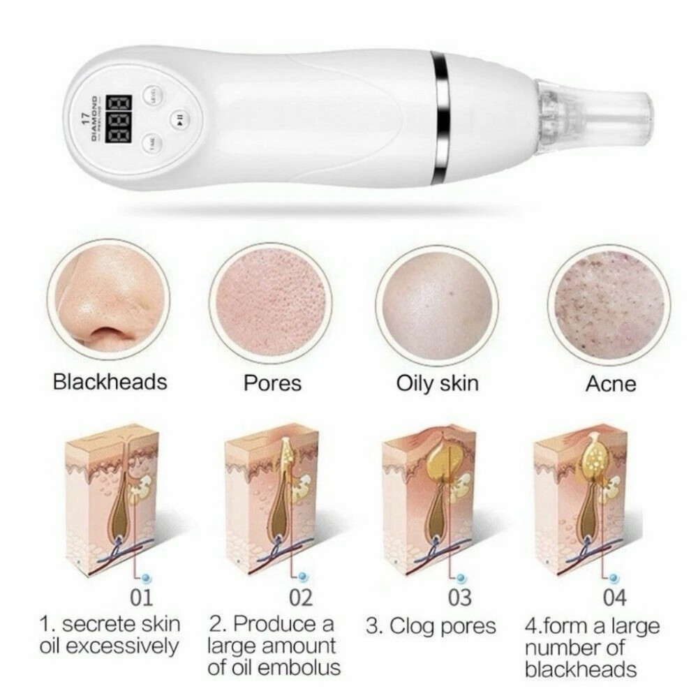 Diamond Dermabrasion Peeling Vacuum Device Machine
