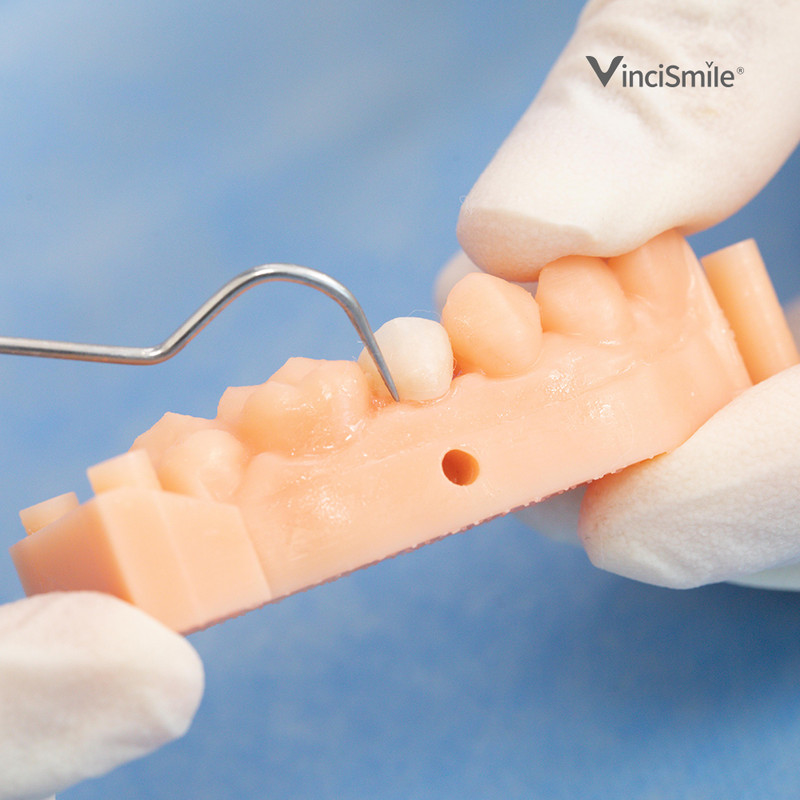 HUGE TOPCEM Veneer System 5pc Cement 5pc Try-in Gel Cementation Restorations Kit