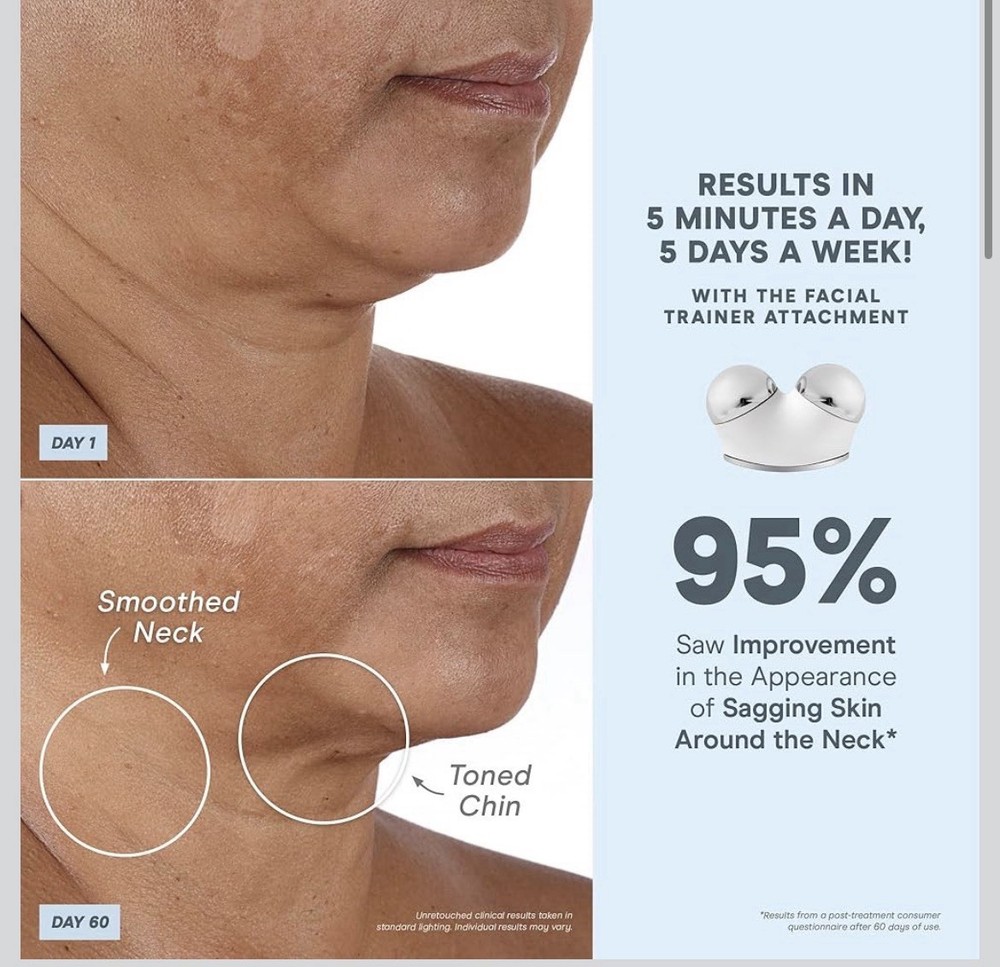 NuFACE Trinity Plus Microcurrent Facial Toning Device