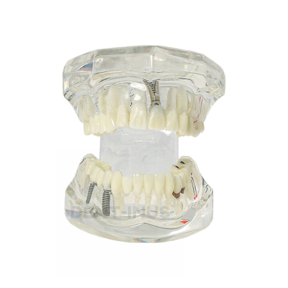 Multiple Types Dental Teeth Model Typodont Ortho Implant Practice Demo Teaching