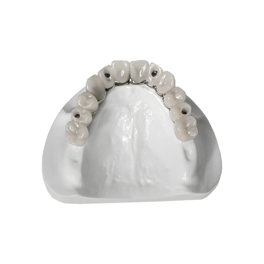 Dental Multi Typodont Teeth Model for Implant Pathological Restoration Practice