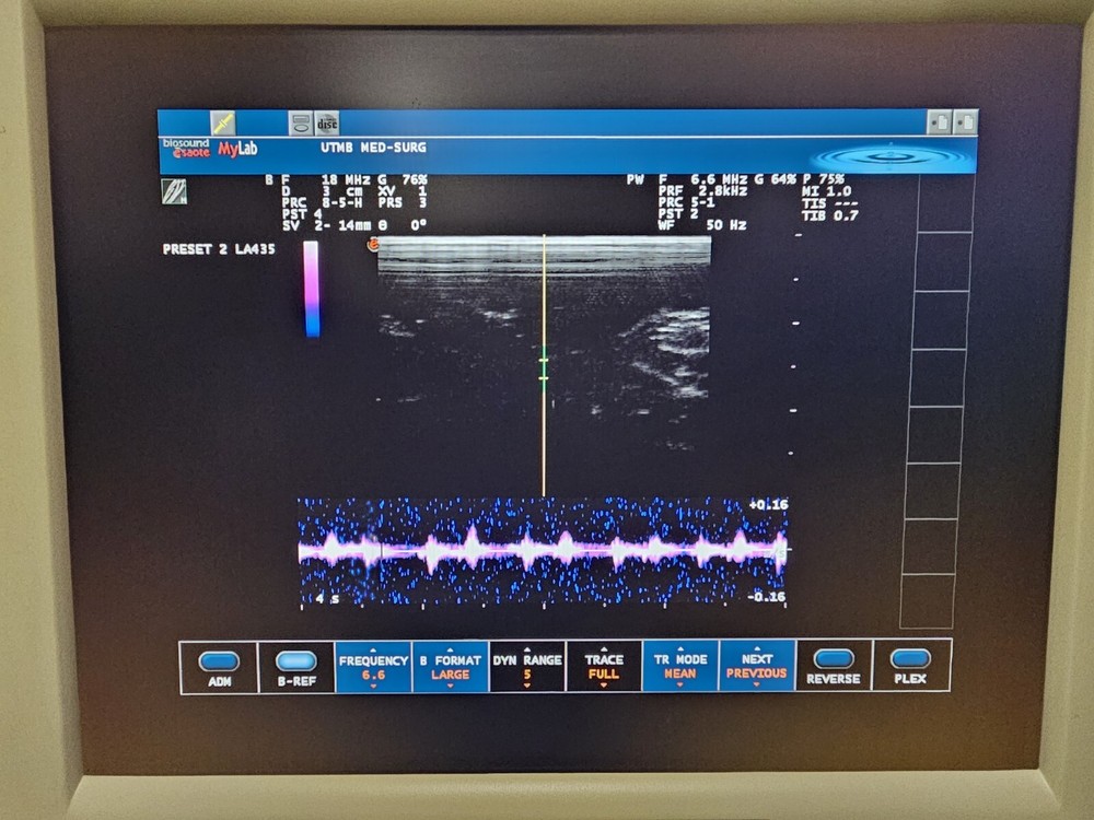Esaote LA435 Linear Array Ultrasound Transducer Ref 9600173000