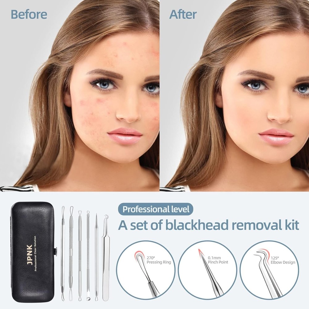 Blackhead Remover Comedone Extractor Acne Removal Kit