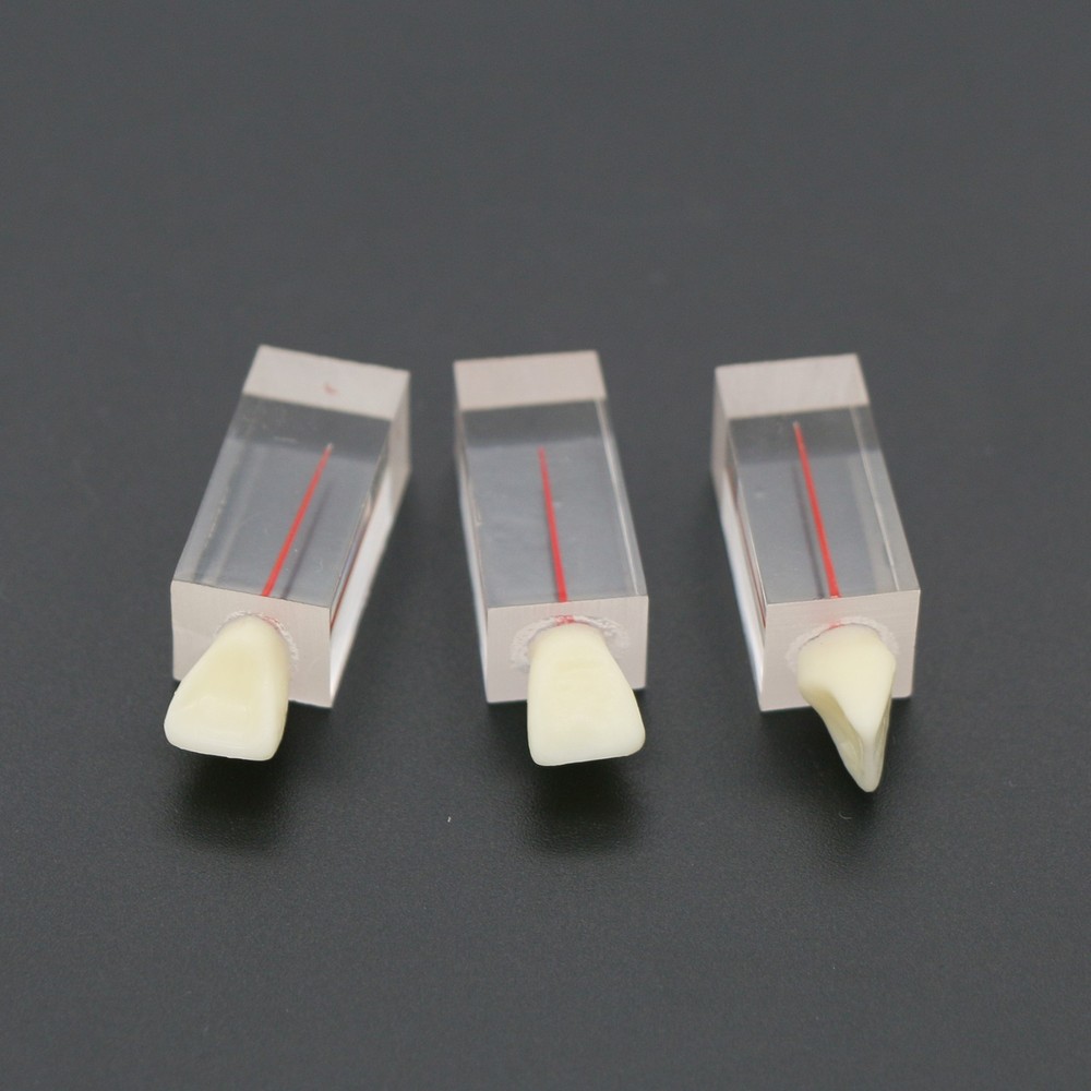 5Pcs Dental Root Canal Teeth molar Model Study Practice For Endodontic Pulp File
