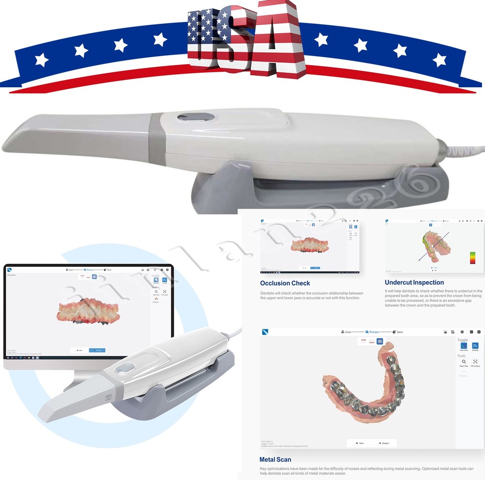 3D Dental Scanner