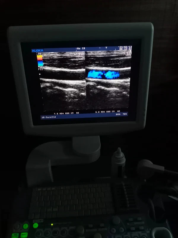 ..aloka UST-5546 linear probe checked dxb