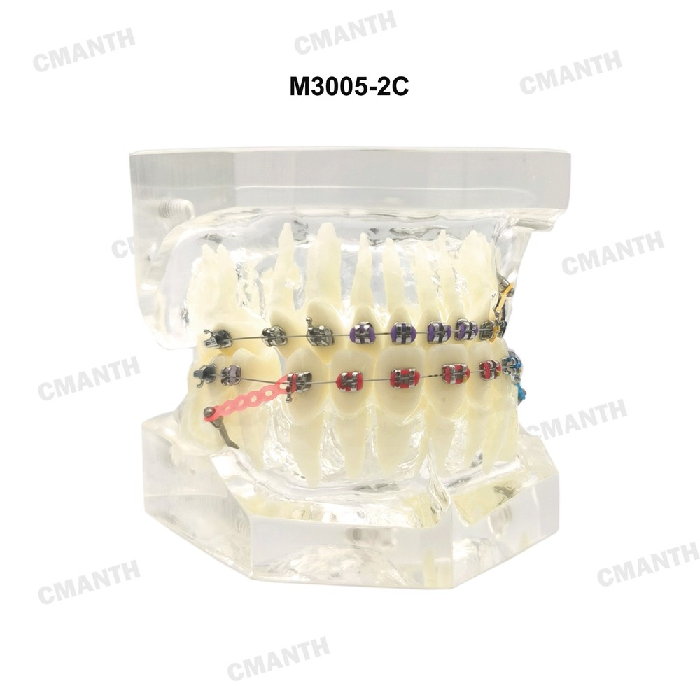 Dental Teeth Model Ceramic Brackets Orthodontic Correction Teaching Model M3005