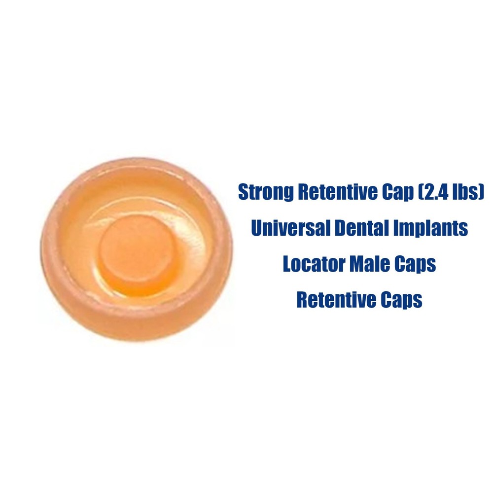 US Locator Overdenture Abutment System Retention Cap Kit and Accessories Inserts
