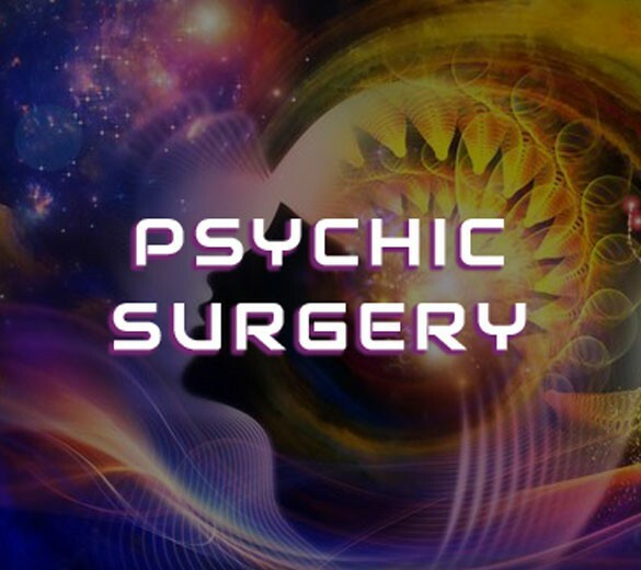 Psychic Surgery