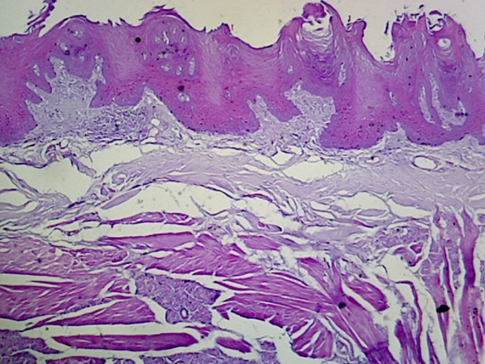 Tongue, Human; Longitudinal Section
