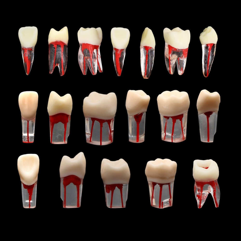 Dental Teeth Root Canal RCT Block Pulp Cavity Practice Model for Endo File Study