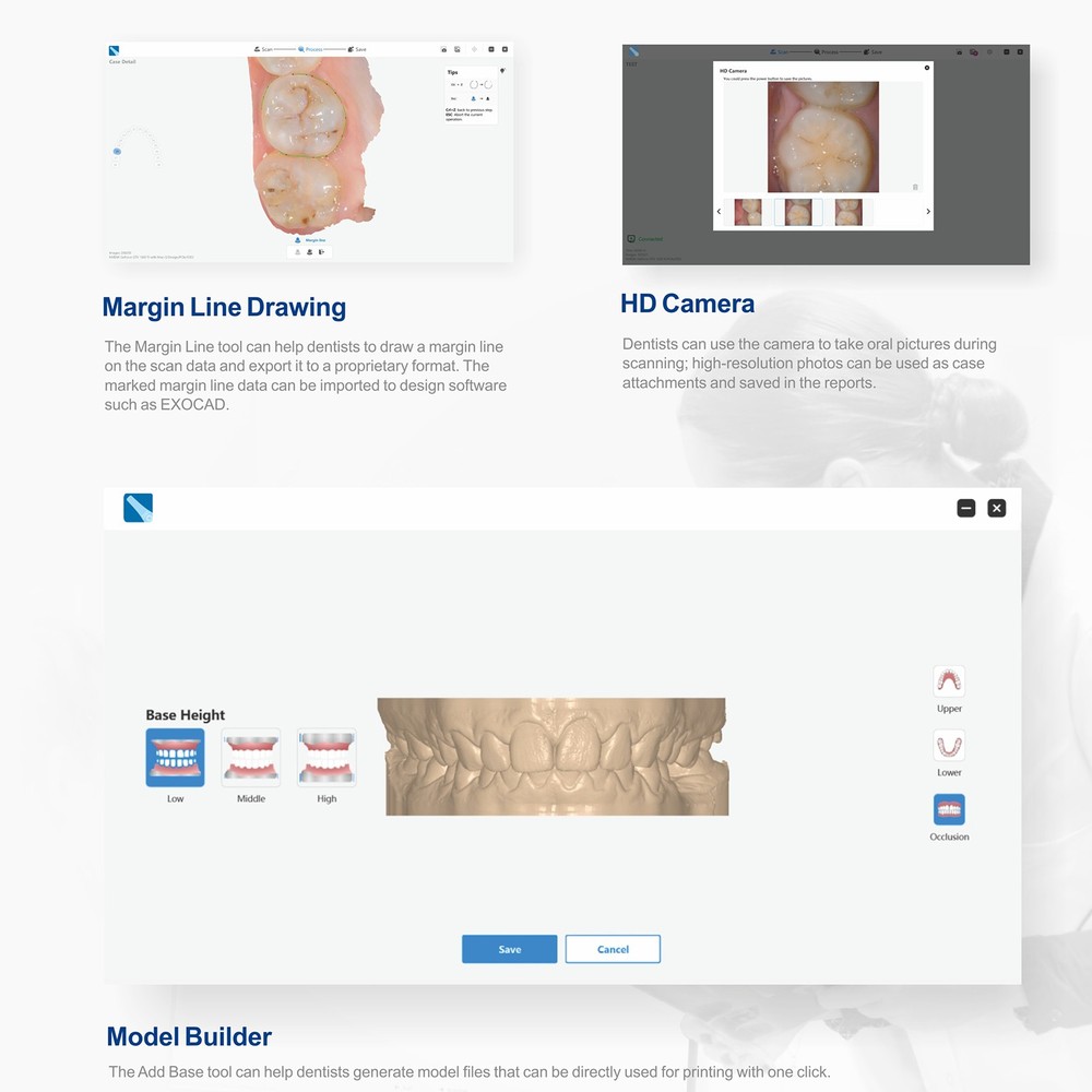 Dent Intra-oral Scanner 3D Real-time Display AI Scanning Software / 4 Tips