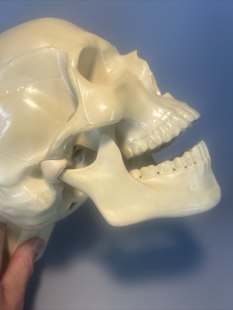 Synbone, Human Skull, Surgical, Training, Education,