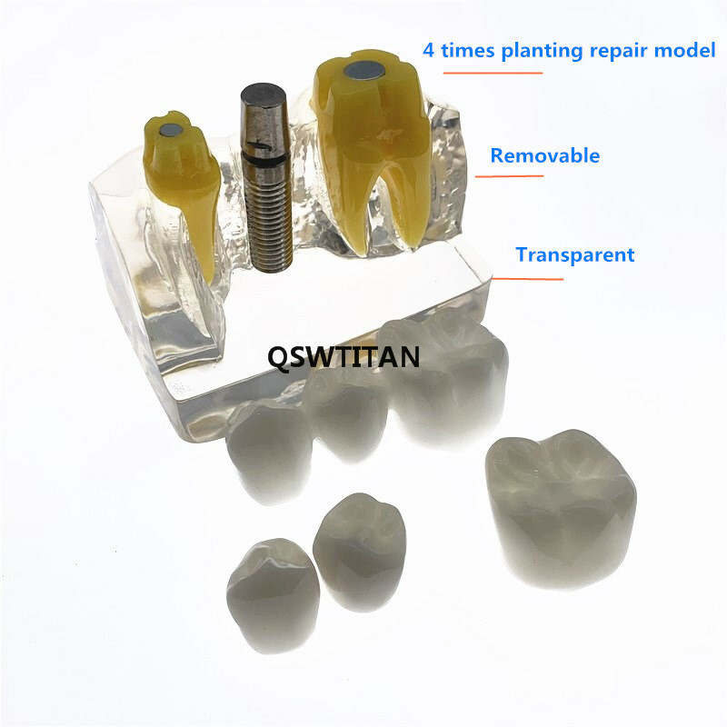 Dental Demonstration Study Teeth Model for Implant Analysis Crown Bridge Model