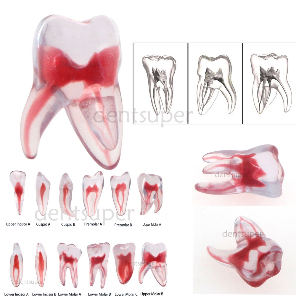 RCT 3D Print Dental Blocks Files Practice Block Endo Training Model Replicas