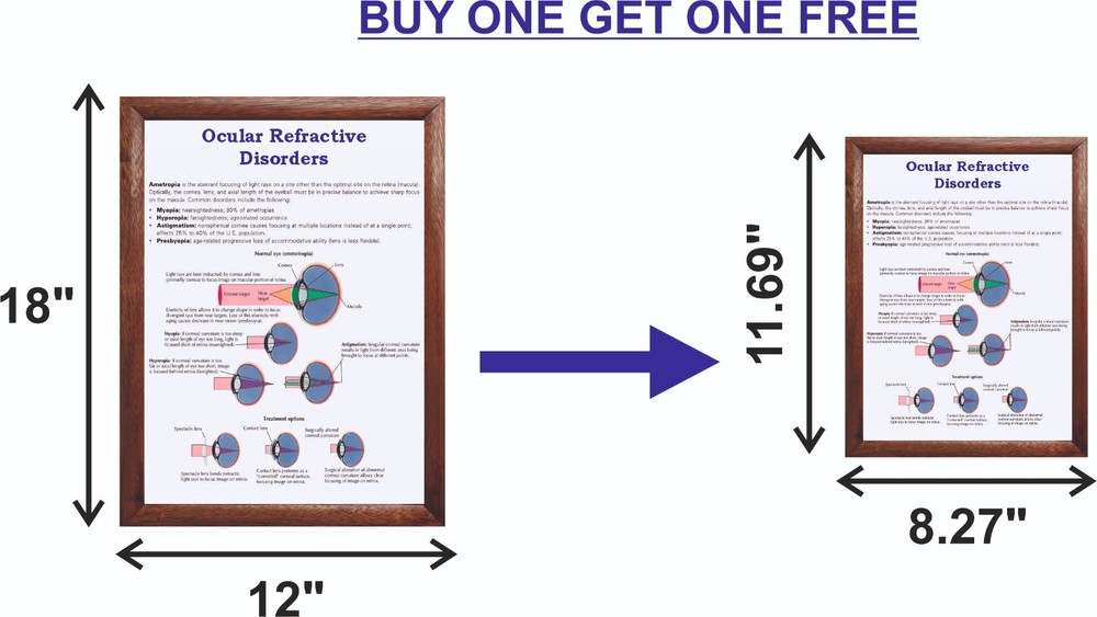 Ocular Refractive Disorders Chart 12x18 inches