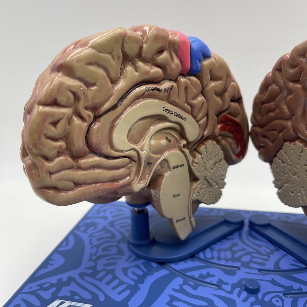 Maxalt Brain Anatomical Model Migraine Pathology Education Teaching Model