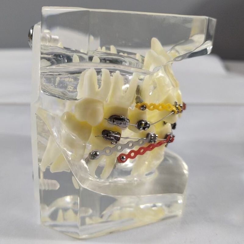 Dental Typodont Orthodontic Treatment Malocclusion Study Model w Brackets Chain