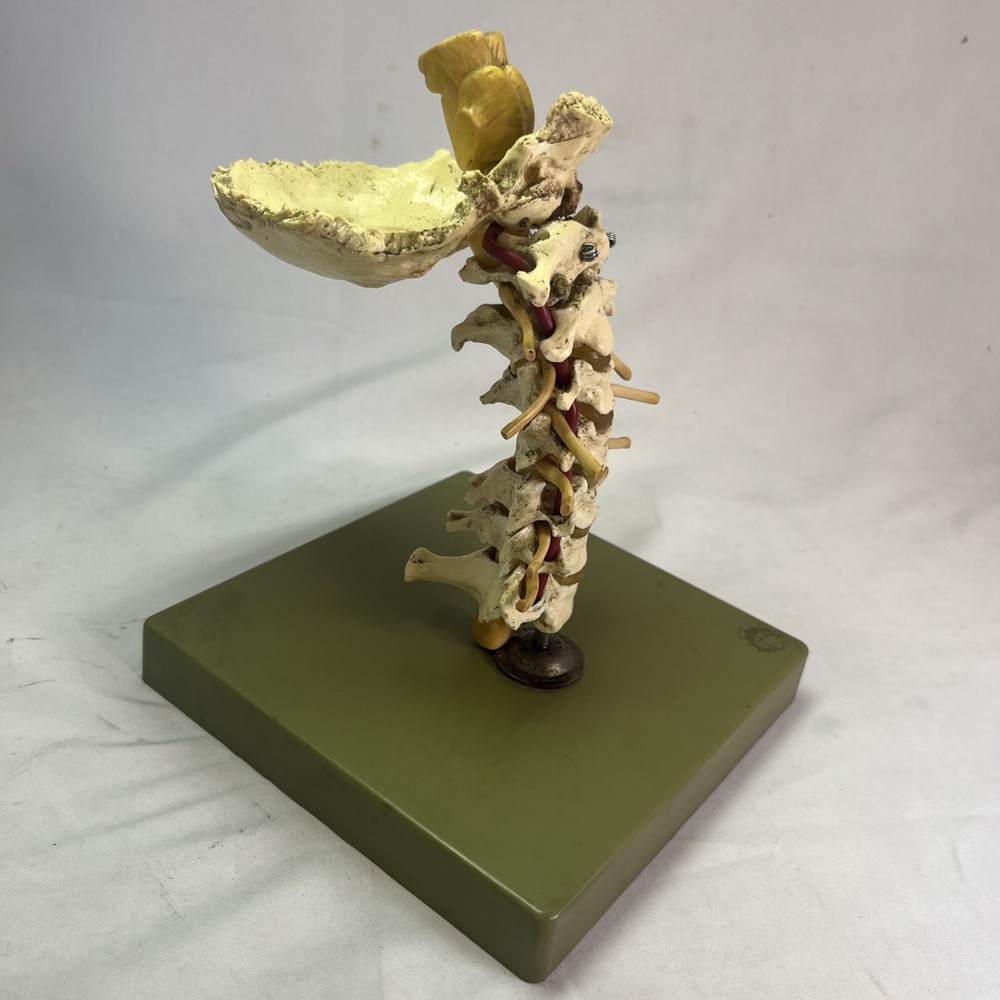 Somso Cervical Spinal Column Anatomical  Model Vintage West Germany - Read