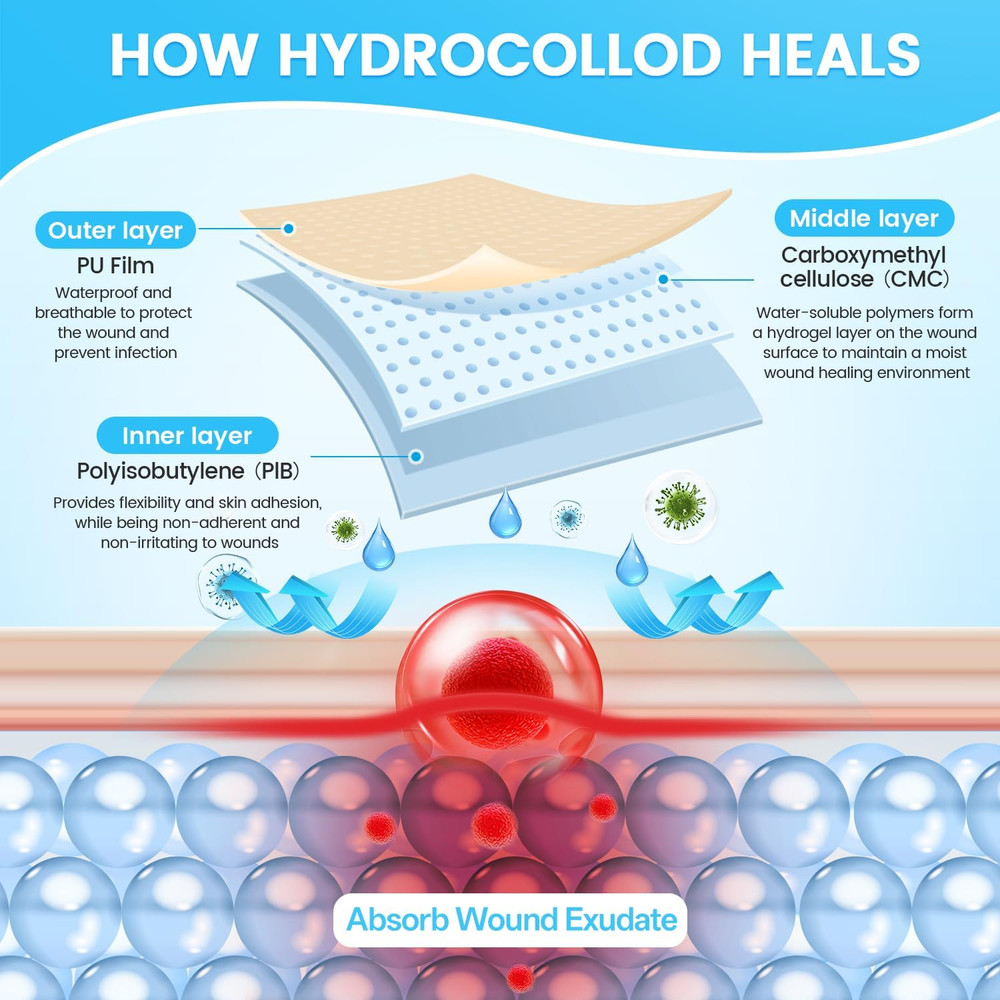 Hydrocolloid Bandage Roll, 2" x 12FT - Advanced Wound Care Solution