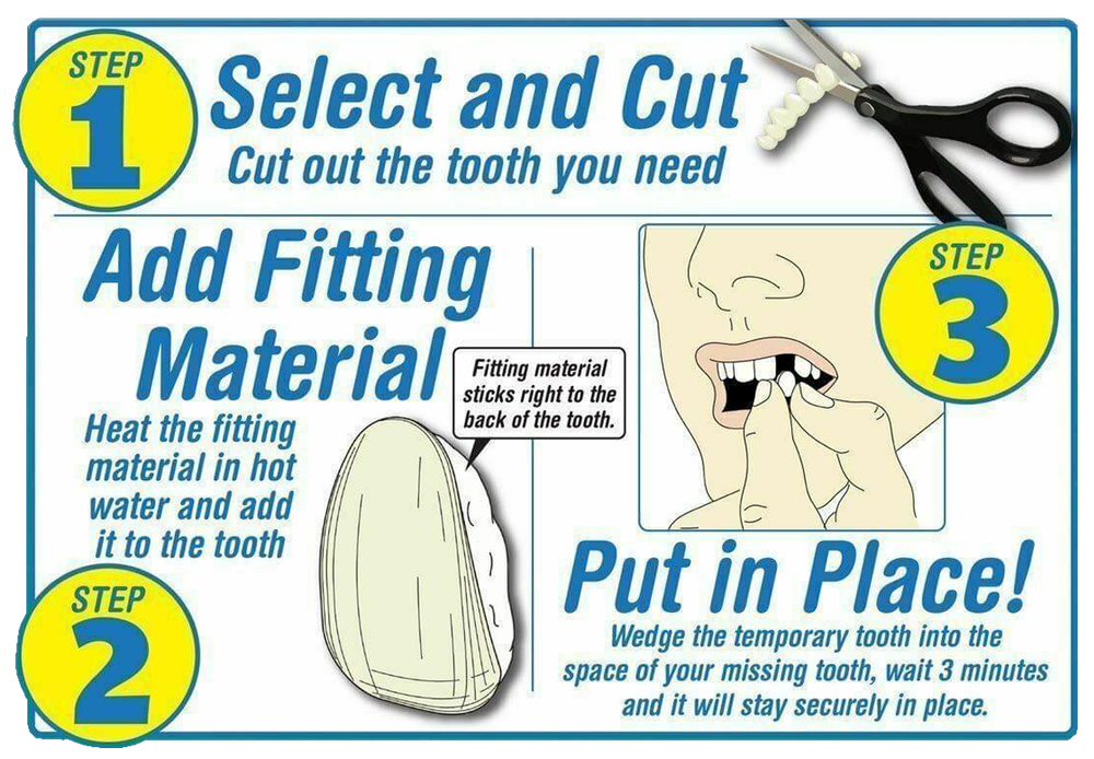 Instant Smile Makeover Select A Tooth Temporary Replacement Kit - All 3 Shades!