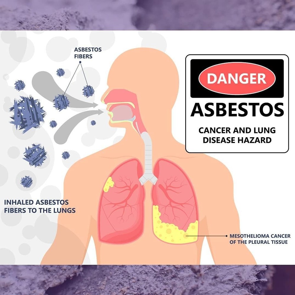 Easy-To-Use Asbestos Testing Kit: 2 Samples with Immediate Online Results
