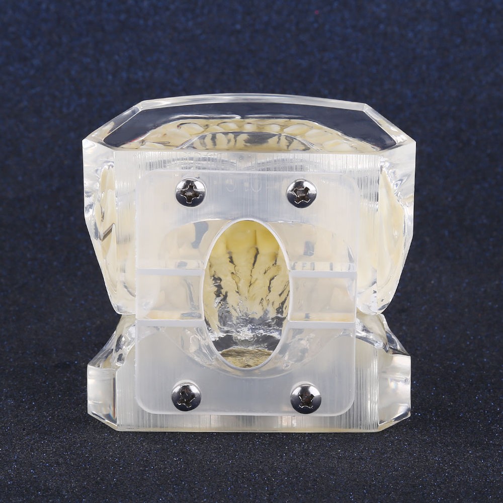 Dental Orthodontic Treatment Malocclusion Study Model With Brackets Chain Wire