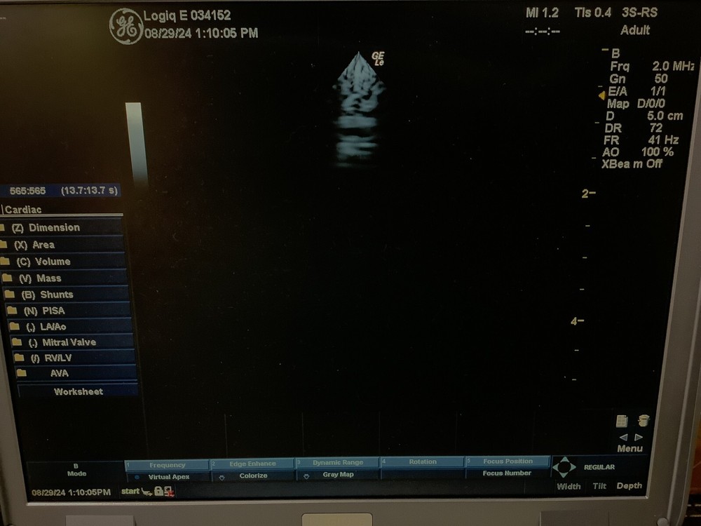 2005 GE 3S-RS Phased Array Ultrasound Probe (White Connector)