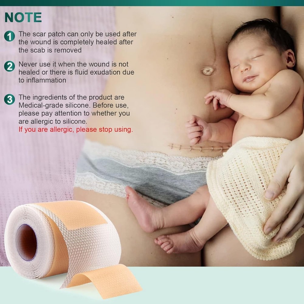 Silicone Scar Sheets, Tape 1.6"x 120" Roll, Light