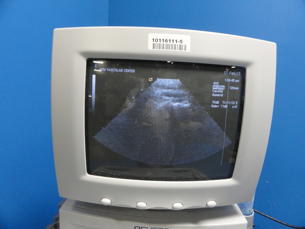 Siemens Acuson 4V2 Vector Array Ultrasound Probe – For Sequoia Series ~ 8584
