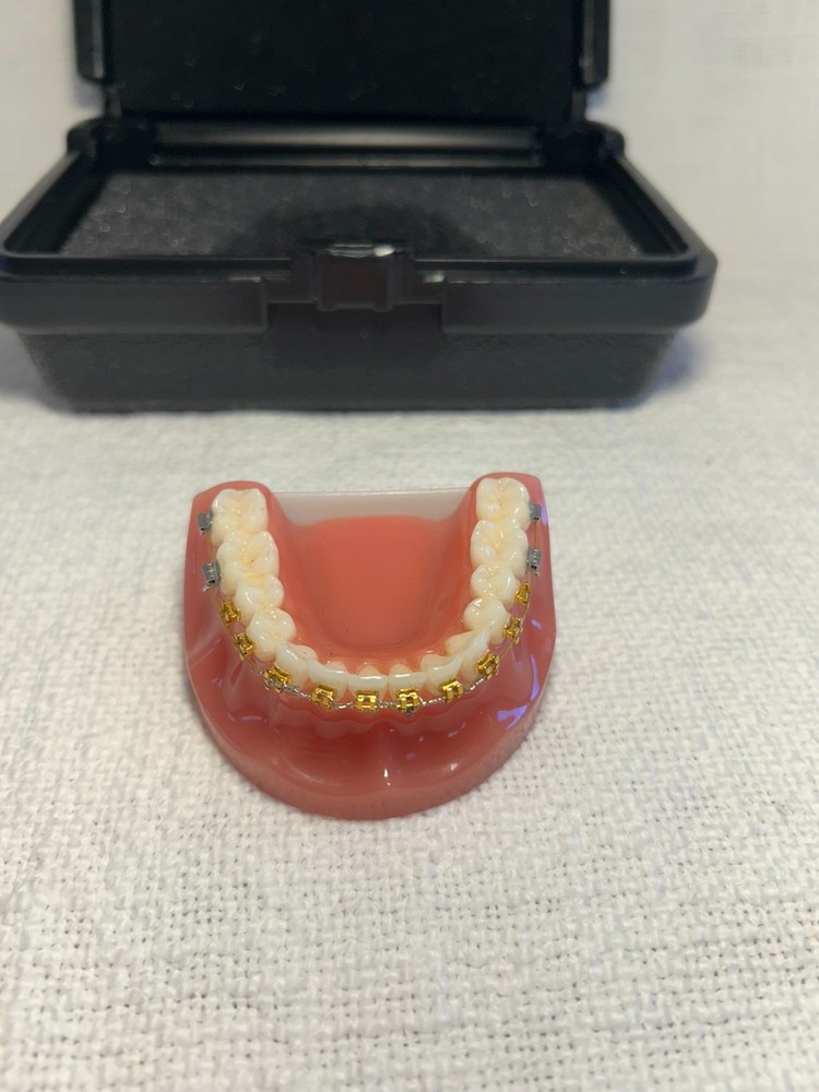 Orthodontic Study Model Dental Typodont - Gold & Silver Braces - Teaching Tool