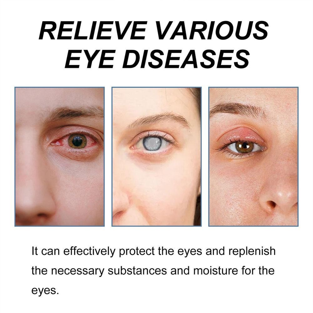 Cataract Removal Eye Drop Improve Blurred Vision Restore Relieve 5ml ❀