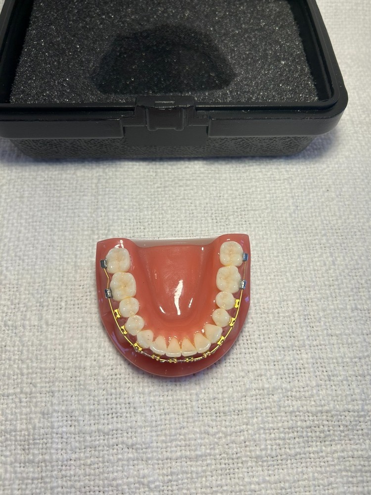 Orthodontic Study Model Dental Typodont - Gold & Silver Braces - Teaching Tool