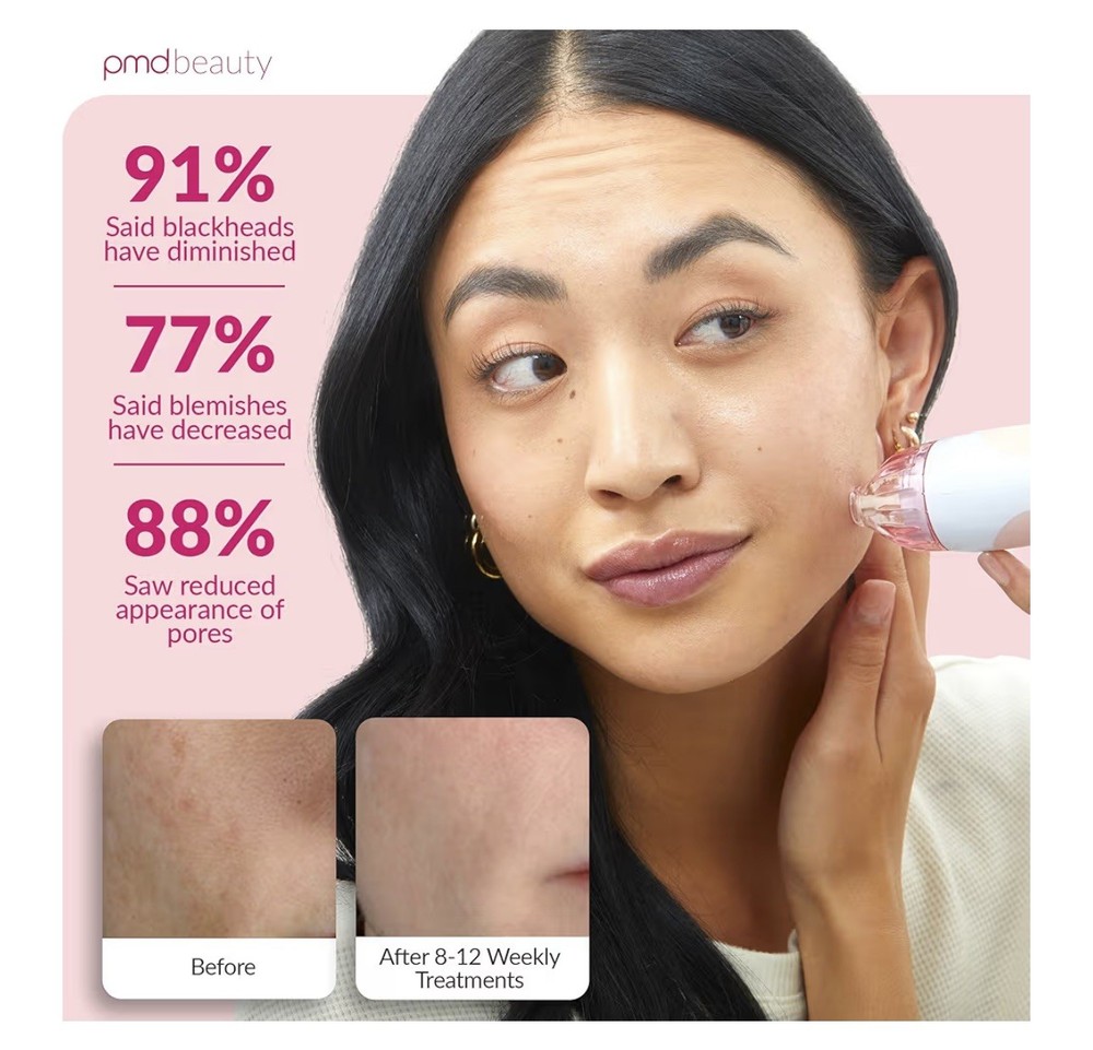 PMD Personal Microderm Classic At-Home Microdermabrasion Machine, Blush