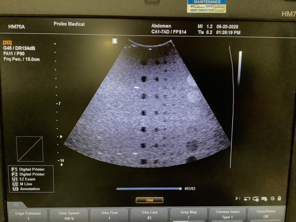 2024 Samsung Medison CA1-7AD (Convex Array) Ultrasound Probe
