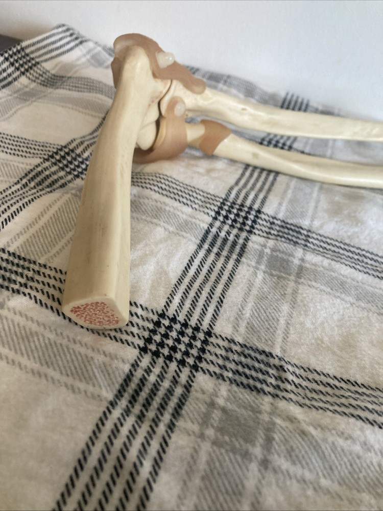 Somso Anatomical Elbow Joint Model. Read