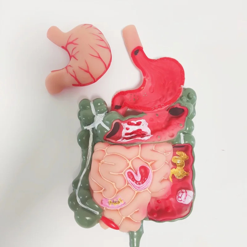 Removerable Human Stomach Anatomy Model Pathological Digestive System Model