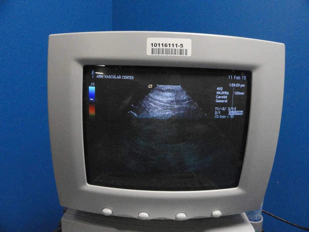 Siemens Acuson 4V2 Vector Array Ultrasound Probe – For Sequoia Series ~ 8584