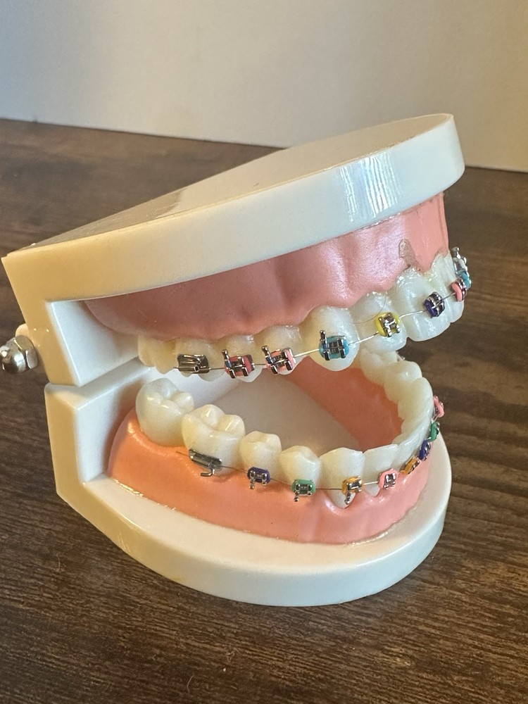Dental Typodont Orthodontic Treatment Teeth Model Malocclusion Study w/ Braces
