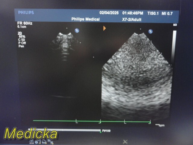 Philips X7-2 Matrix Sector Array Ultrasound Transducer Ref 453561192603 ~ 36256