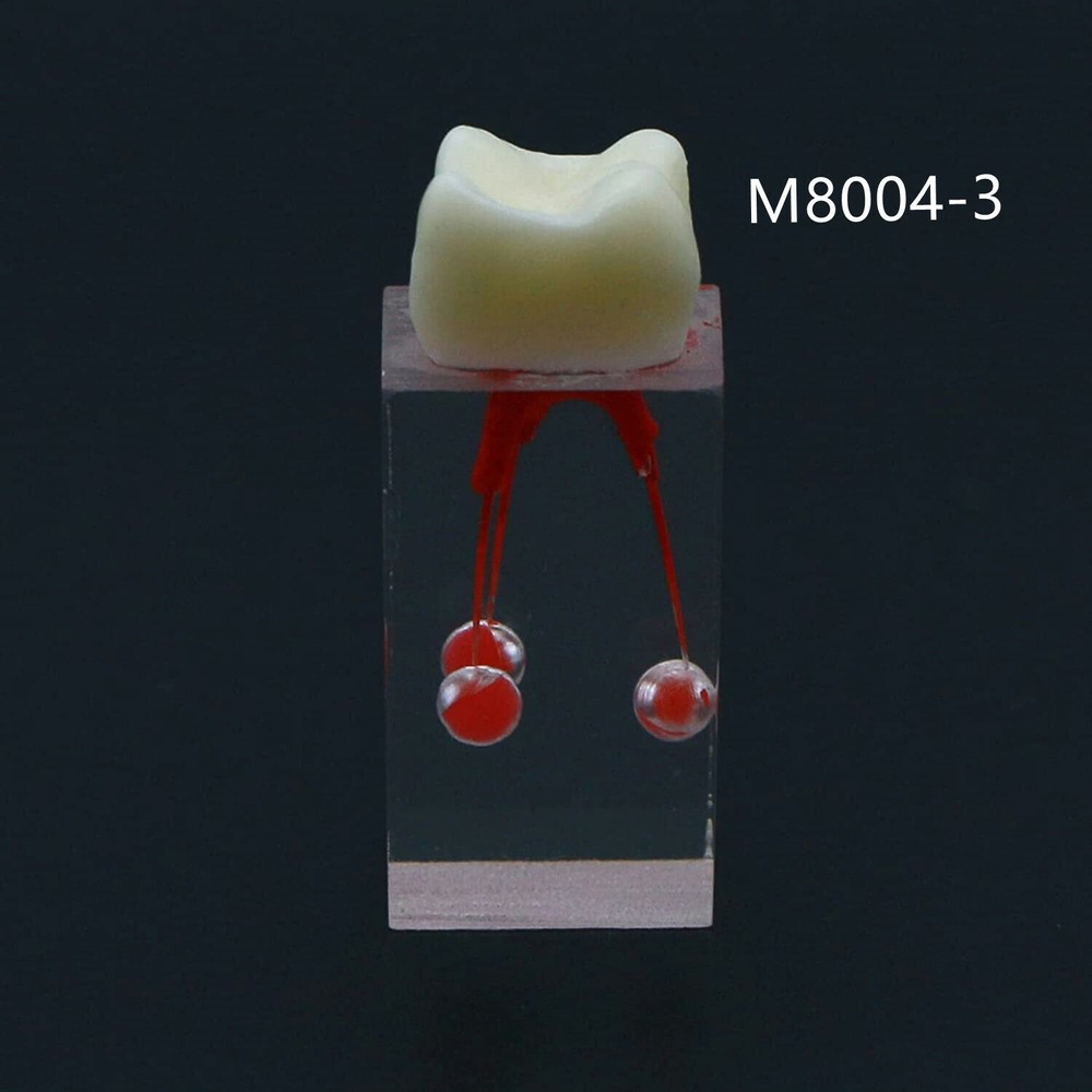 Dental Resin Training Study Endo Root Canal Teeth Model Practice Block RCT Pulp