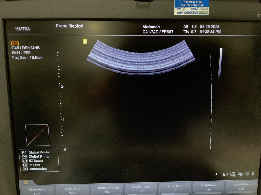 2024 Samsung Medison CA1-7AD (Convex Array) Ultrasound Probe