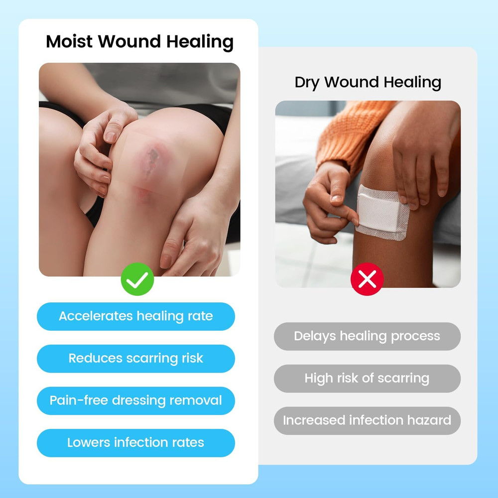 Hydrocolloid Bandage Roll, 2" x 12FT - Advanced Wound Care Solution