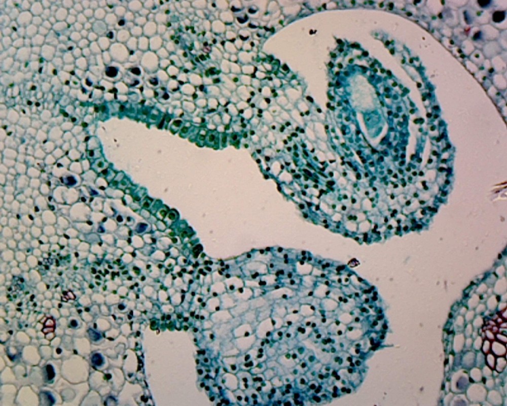 Lilium Ovary; Cross Section