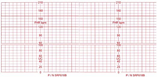 ECG PAPER 112mm x 100mm x 100 sheets (10)