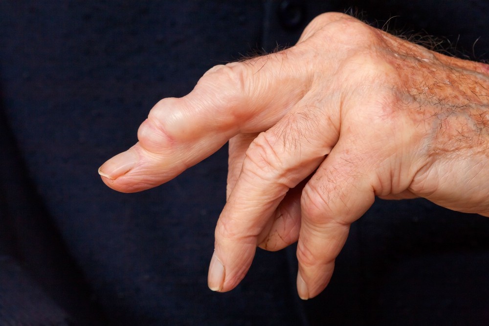 Ganglion cyst stimulator.
