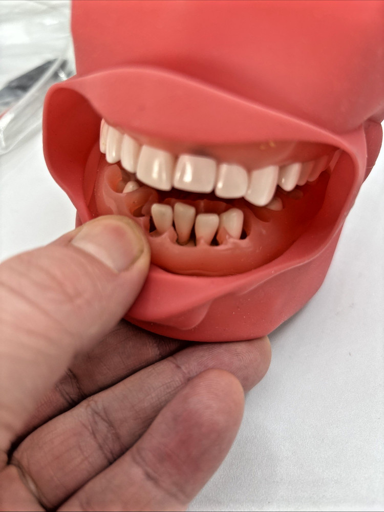 Dental Training Manikin with removeable teeth. MISSING 2 TEETH. Open Box SAVE 💲