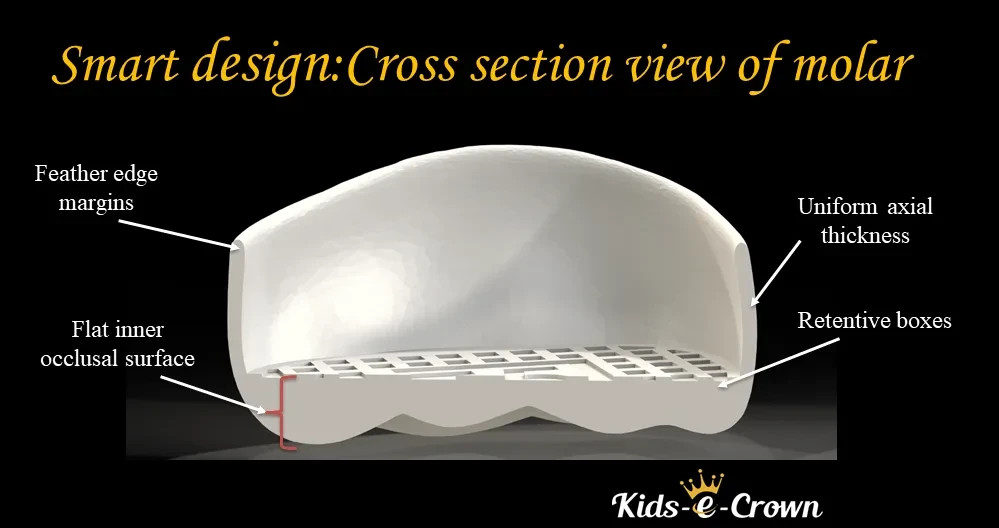 Kids-e-Crown Zirconia Crowns Primary First Molar Kits