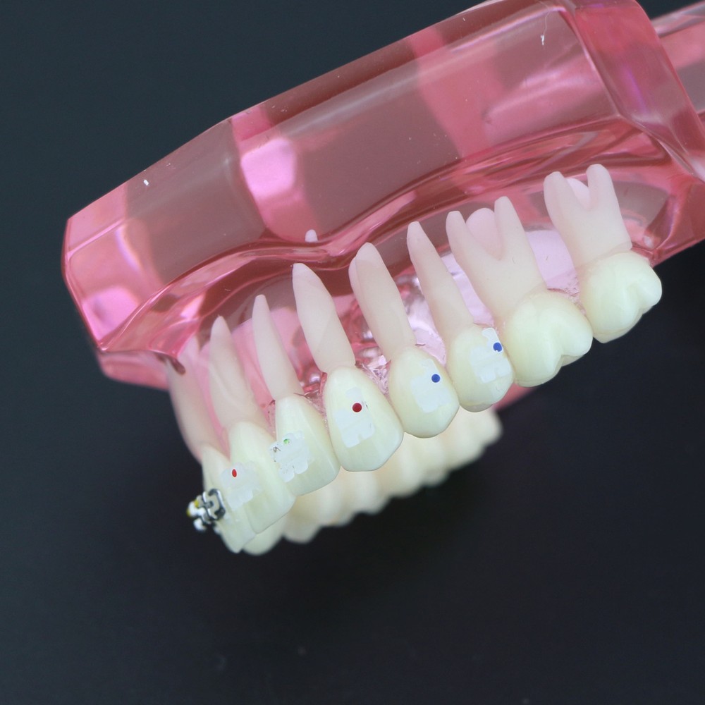Dental Orthodontic Teeth Model Metal and Ceramic Bracket Study Teach Model 3003